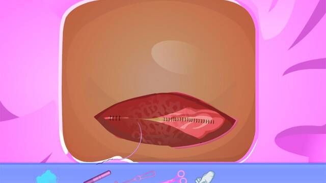 Nacimiento por cesárea -