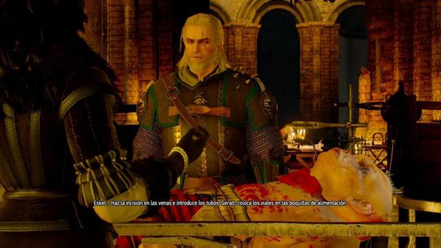 The Witcher 3: Wild Hunt - Va fail, Elaine - Se trata de un procedimiento duro y cruel